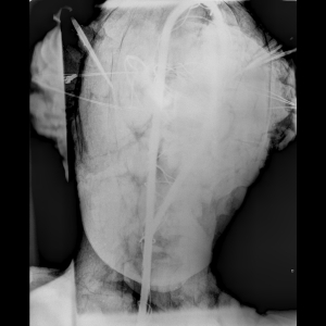X-ray Muse Head